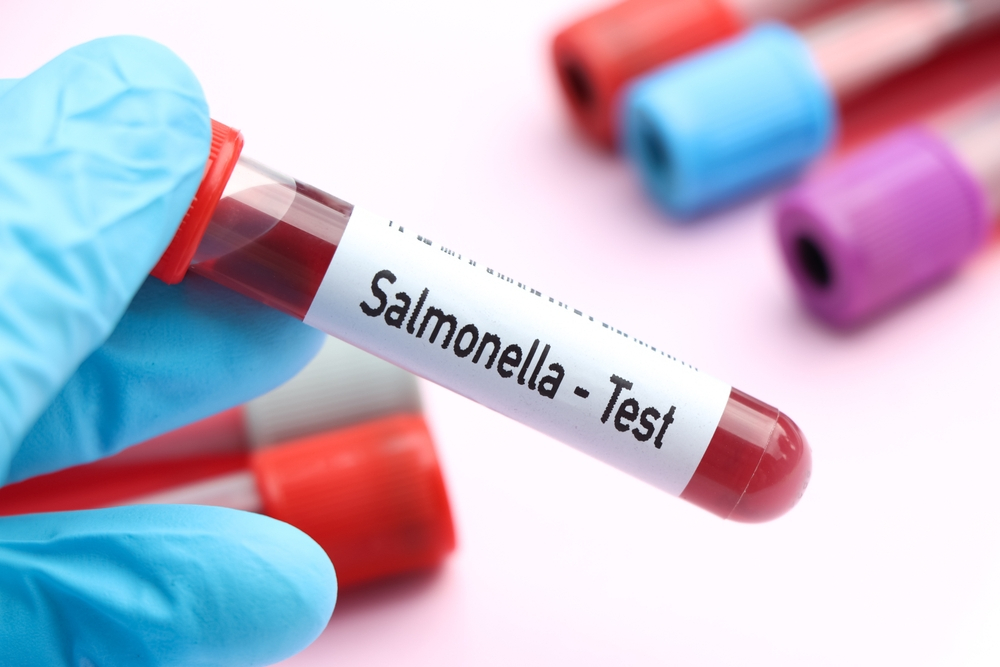 ict for salmonella test price in bangladesh