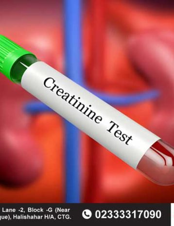 serum creatinine test price in bangladesh