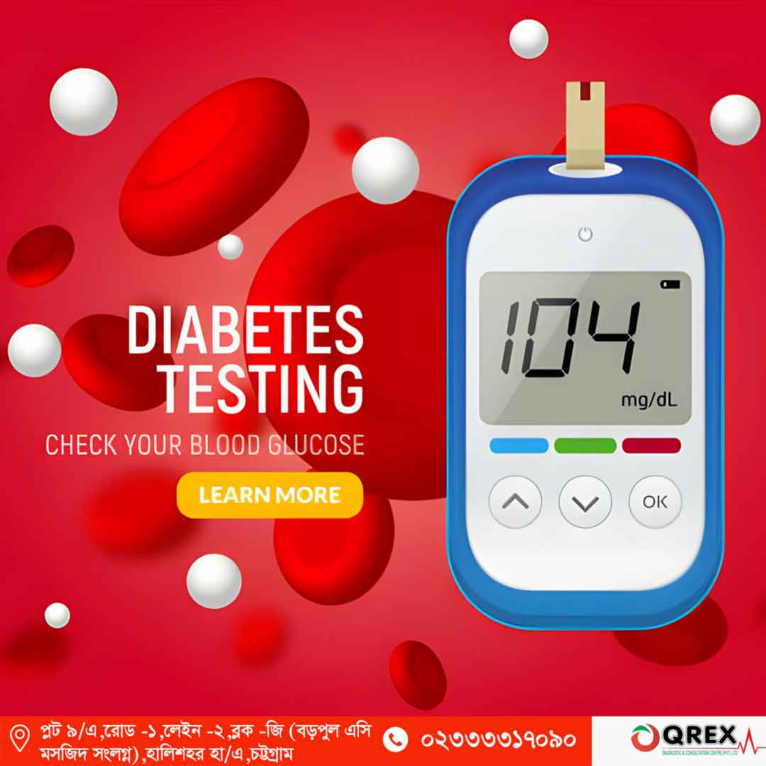 Oral Glucose Tolerance Test - Qrex Diagnostic & Consultation Center